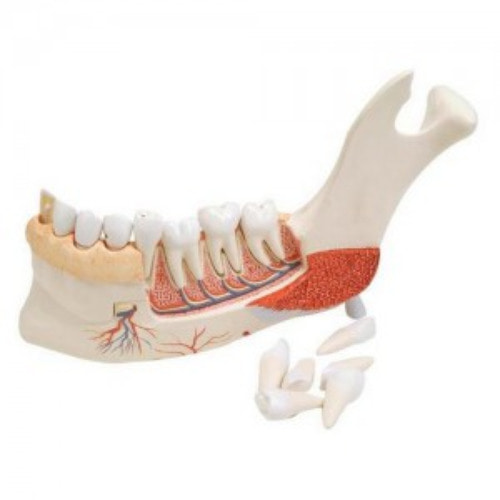 치아질환이 있는 하악 모형 19파트(VE290)